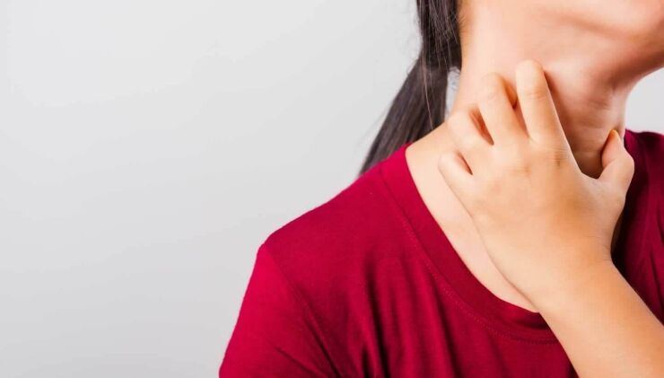 Is Psoriasis Itching? Learn About Psoriasis Flare-Ups